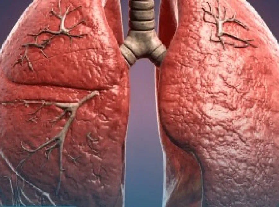 Medicamento experimental desacelera fibrose pulmonar